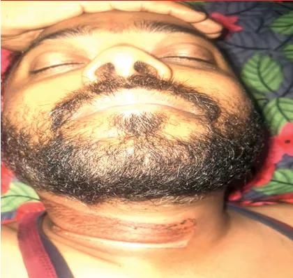 नीमच में सड़क पर लटकती केबल बनी हादसे की वजह, बाइक सवार युवक घायल; CCTV में घटना कैद